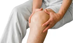 Leg swelling