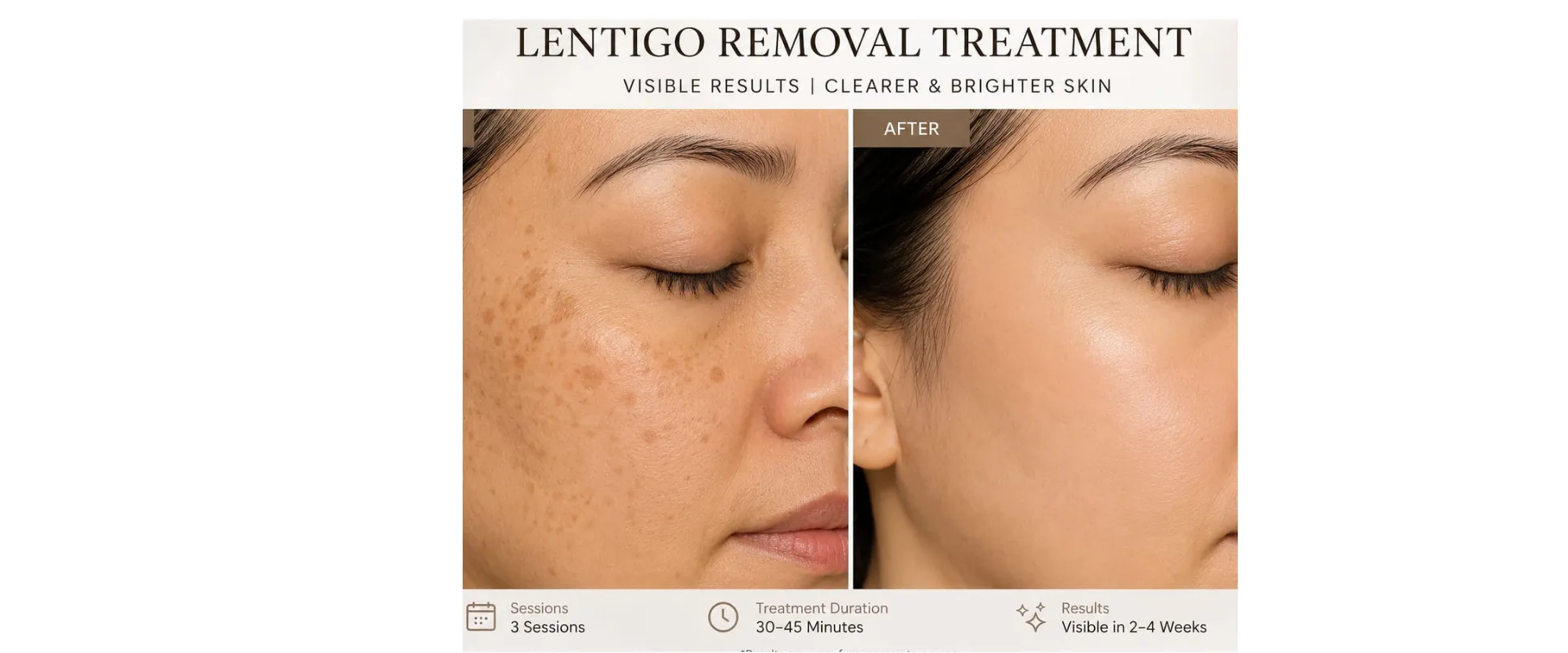 Sensitive skin facial treatment