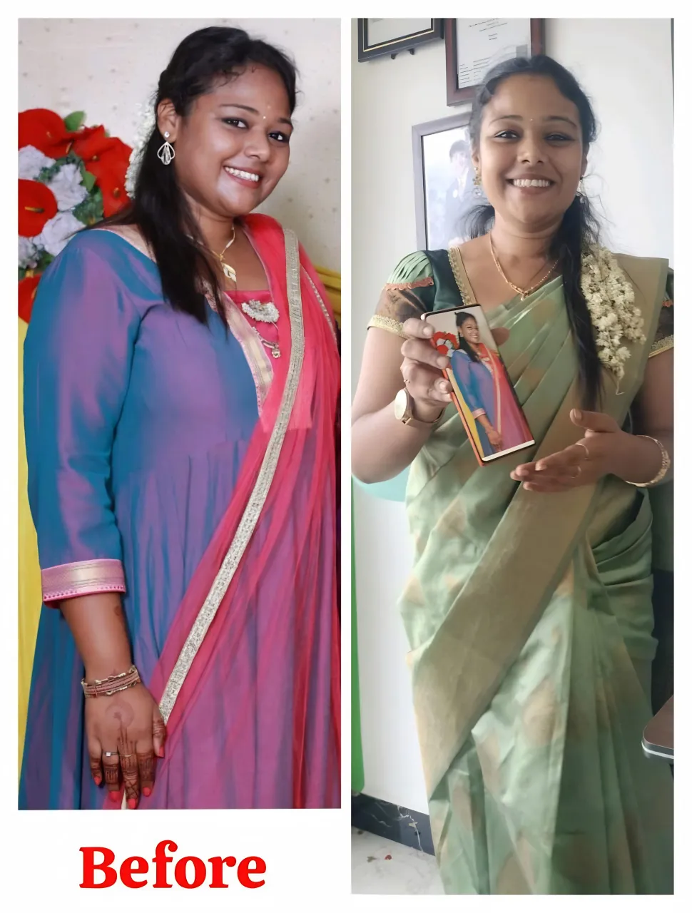 Before-After 1