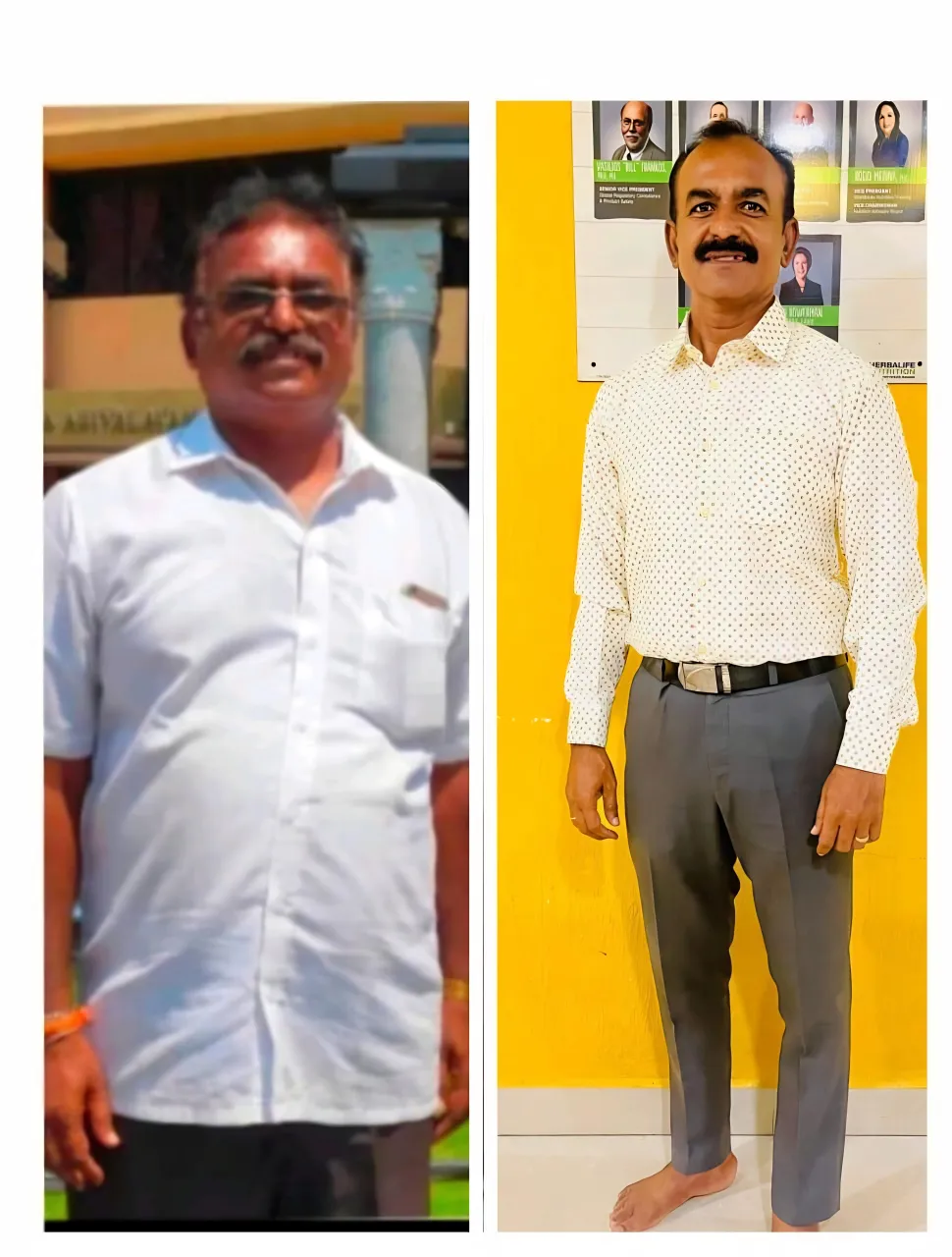 Before-After 2