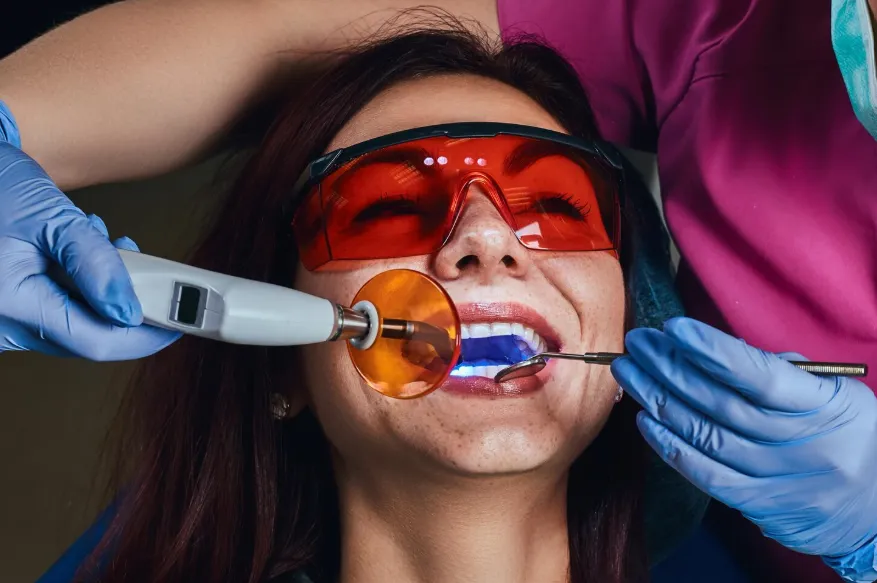 Tooth Color Filling