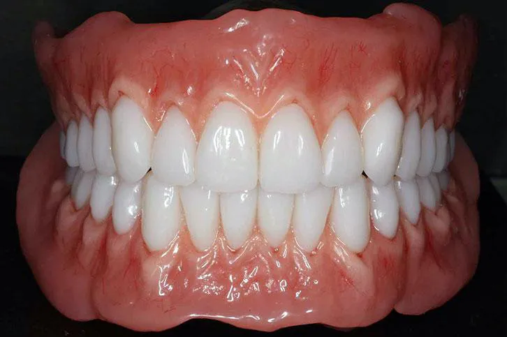 Dentures