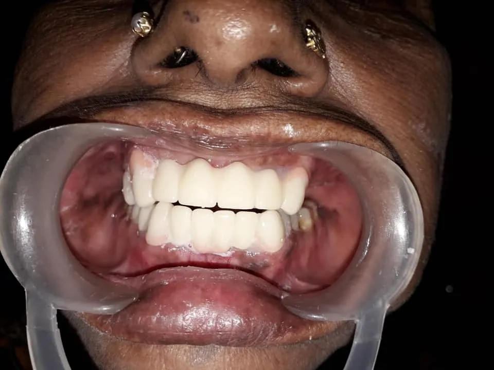 After Treatment