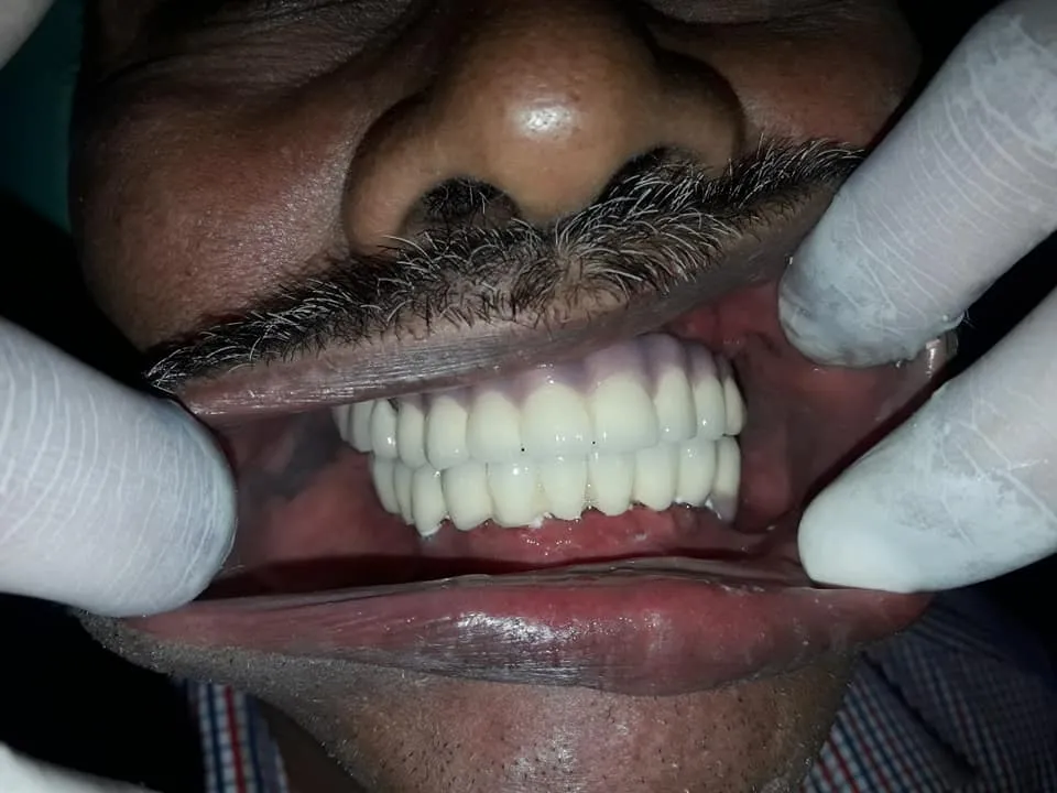 After Treatment
